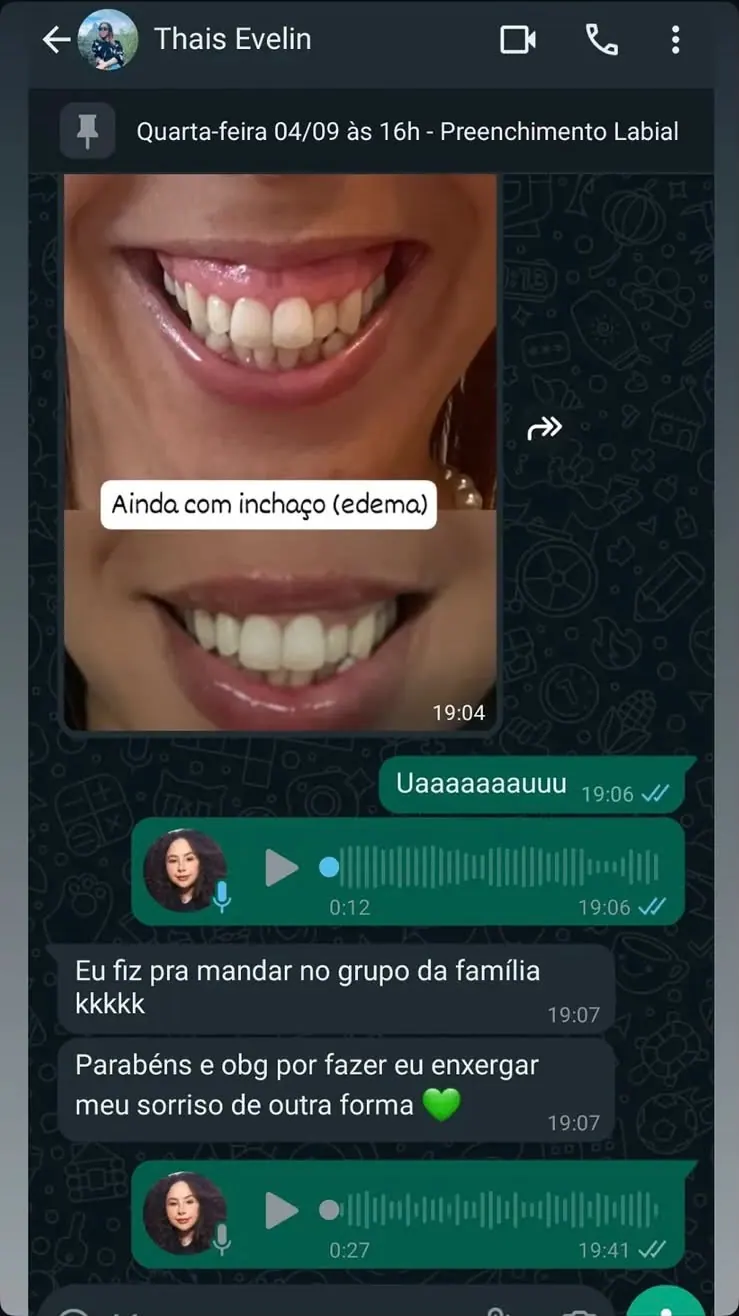 “Parabéns e obrigada por fazer eu enxergar meu sorriso de outra forma.”
